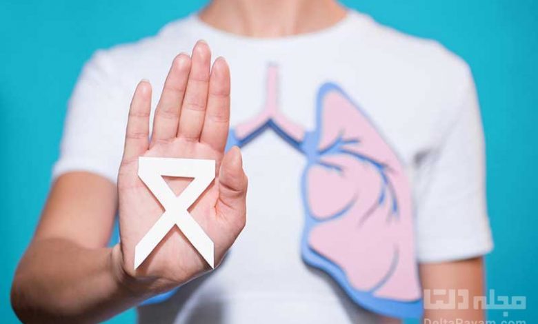 ۸ علامت سرطان ریه که باید بدانید
